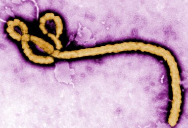 Ebola virus purple0