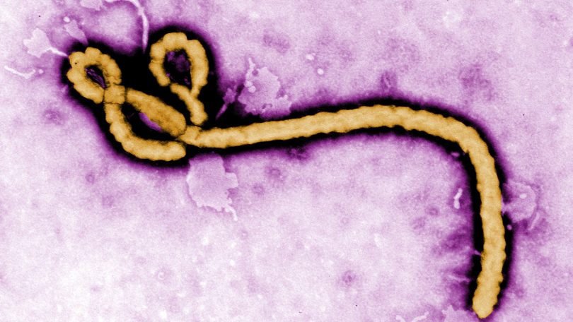 Ebola virus purple0