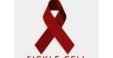 sickle cell