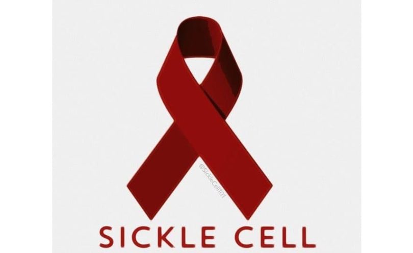 sickle cell