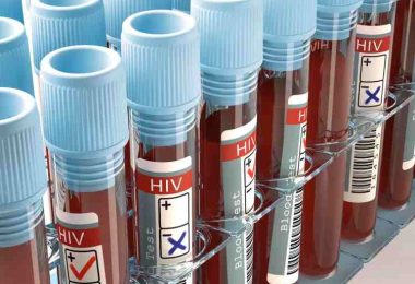 HIV