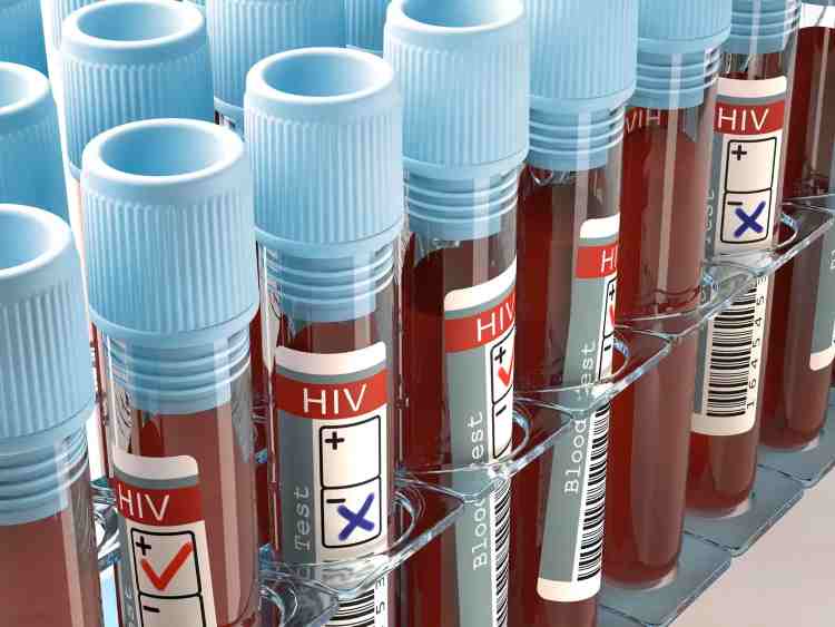 HIV